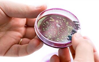 Bakterien im Prostatasekret.